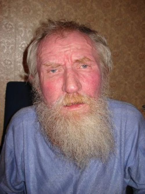 запойный алкоголик
