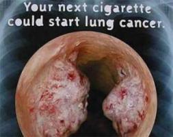 The effects of smoking on the vocal cords